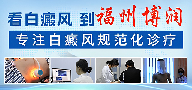 福州白癜风医院